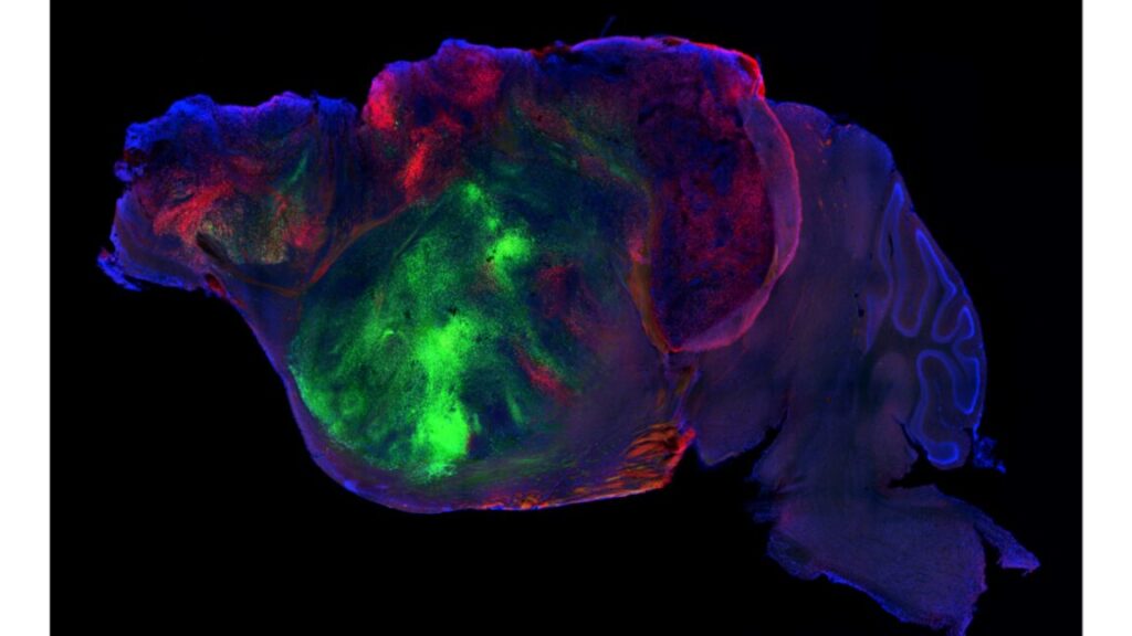 Researchers-are-swapping-human-brain-cells-for-the-cerebral-cortex.jpeg