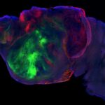 Researchers-are-swapping-human-brain-cells-for-the-cerebral-cortex.jpeg